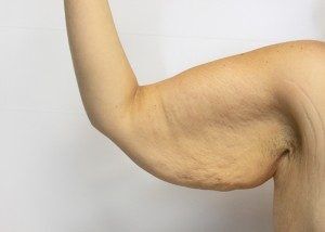 RGV Cosmetic Surgery Vein Care 