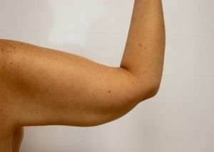 RGV Cosmetic Surgery Vein Care 
