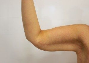 RGV Cosmetic Surgery Vein Care 
