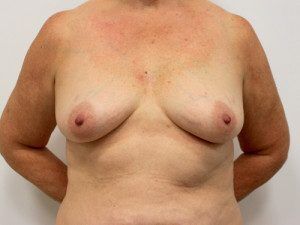 RGV Cosmetic Surgery Vein Care 