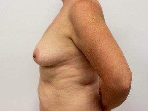 RGV Cosmetic Surgery Vein Care 