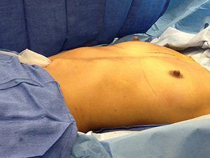 RGV Cosmetic Surgery Vein Care 