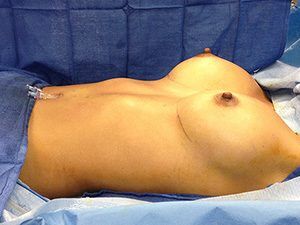 RGV Cosmetic Surgery Vein Care 