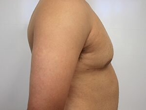 RGV Cosmetic Surgery Vein Care 