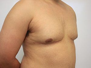 RGV Cosmetic Surgery Vein Care 