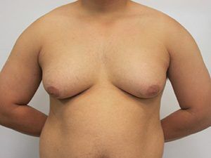 RGV Cosmetic Surgery Vein Care 