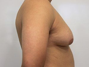 RGV Cosmetic Surgery Vein Care 