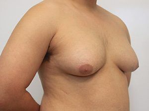 RGV Cosmetic Surgery Vein Care 