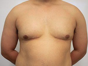 RGV Cosmetic Surgery Vein Care 