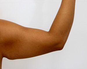 RGV Cosmetic Surgery Vein Care 