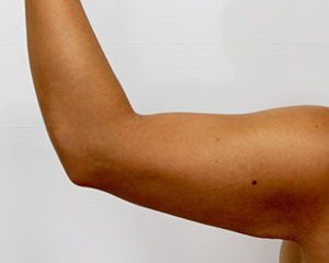 RGV Cosmetic Surgery Vein Care 