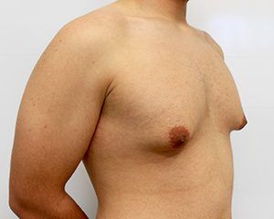 RGV Cosmetic Surgery Vein Care 