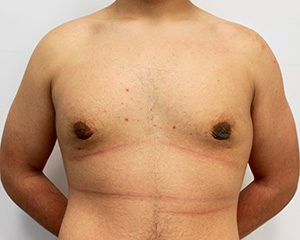 RGV Cosmetic Surgery Vein Care 