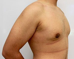 RGV Cosmetic Surgery Vein Care 