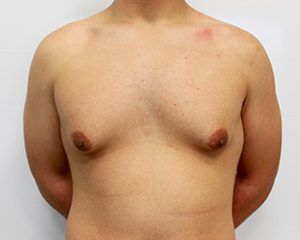 RGV Cosmetic Surgery Vein Care 