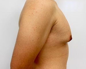 RGV Cosmetic Surgery Vein Care 