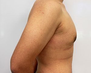 RGV Cosmetic Surgery Vein Care 
