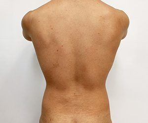 RGV Cosmetic Surgery Vein Care 