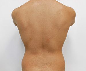 RGV Cosmetic Surgery Vein Care 