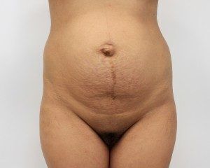 RGV Cosmetic Surgery Vein Care 