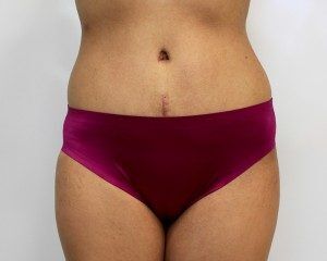 RGV Cosmetic Surgery Vein Care 
