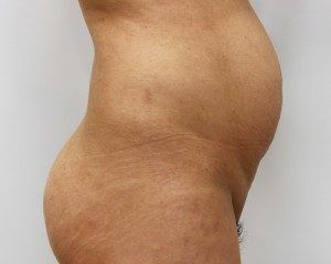 RGV Cosmetic Surgery Vein Care 