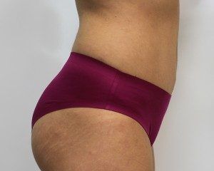 RGV Cosmetic Surgery Vein Care 
