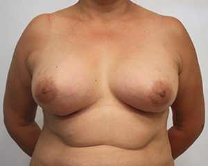 RGV Cosmetic Surgery Vein Care 