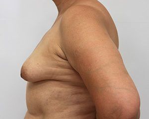 RGV Cosmetic Surgery Vein Care 
