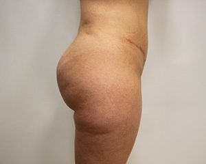 RGV Cosmetic Surgery Vein Care 