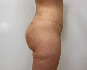 RGV Cosmetic Surgery Vein Care 