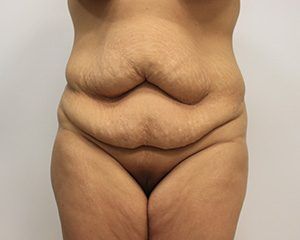 RGV Cosmetic Surgery Vein Care 