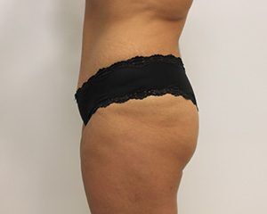 RGV Cosmetic Surgery Vein Care 