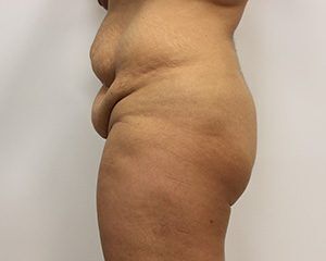 RGV Cosmetic Surgery Vein Care 