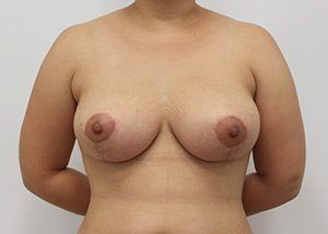 RGV Cosmetic Surgery Vein Care 