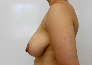 RGV Cosmetic Surgery Vein Care 