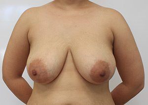 RGV Cosmetic Surgery Vein Care 