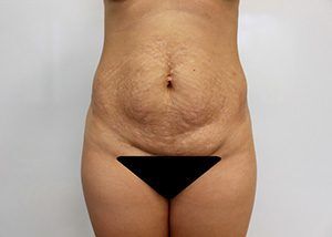 RGV Cosmetic Surgery Vein Care 