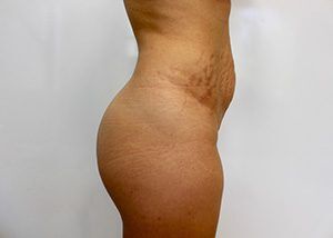 RGV Cosmetic Surgery Vein Care 