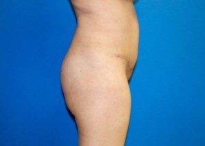 RGV Cosmetic Surgery Vein Care 
