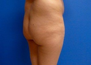 RGV Cosmetic Surgery Vein Care 