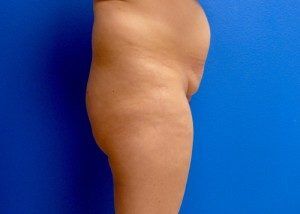 RGV Cosmetic Surgery Vein Care 
