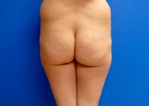 RGV Cosmetic Surgery Vein Care 