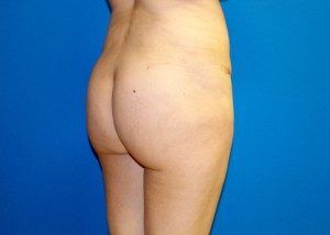 RGV Cosmetic Surgery Vein Care 