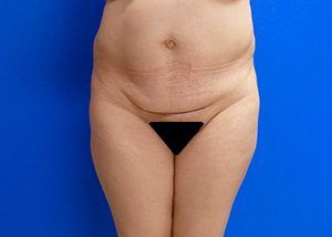 RGV Cosmetic Surgery Vein Care 