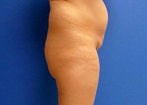 RGV Cosmetic Surgery Vein Care 