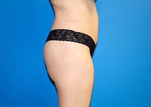 RGV Cosmetic Surgery Vein Care 