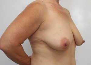 RGV Cosmetic Surgery Vein Care 