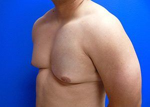 RGV Cosmetic Surgery Vein Care 