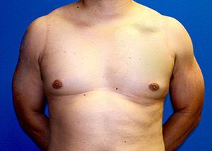 RGV Cosmetic Surgery Vein Care 